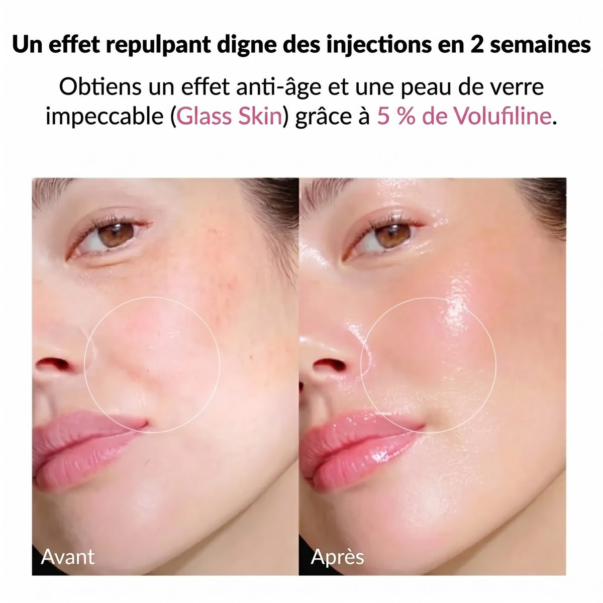 Avant / après – effet repulpant